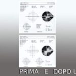 campo visivo prima e dopo l'agopuntura, Metodo Boel , Dr Marzio Vanzini