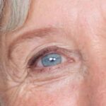 come la circolazione sanguigna influisce sulla progressione del glaucoma, Dr Marzio Vanzini, Metodo Boel