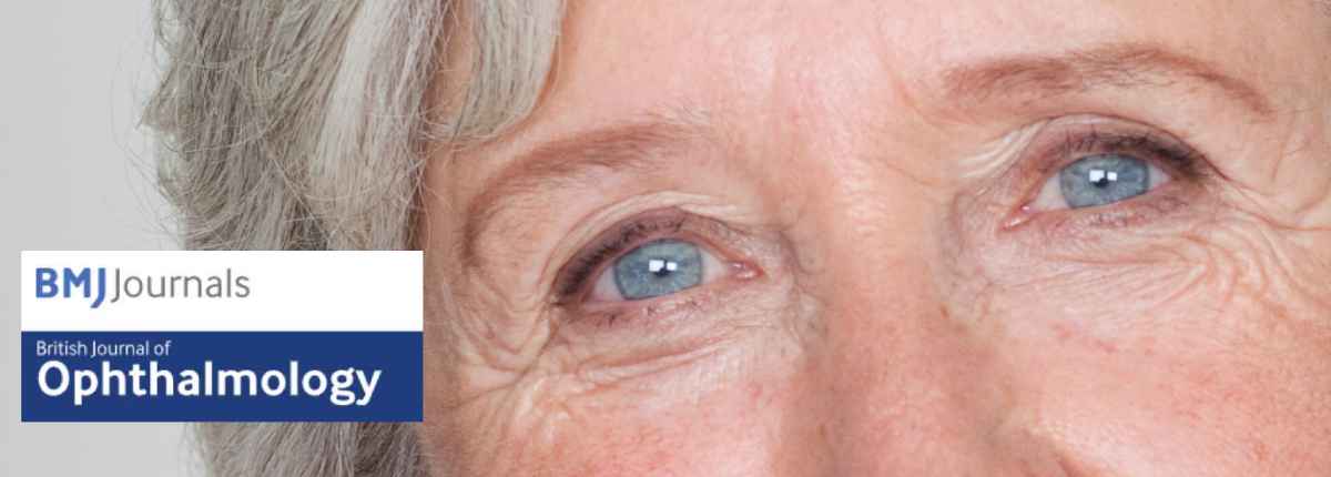 come la circolazione sanguigna influisce sulla progressione del glaucoma, Dr Marzio Vanzini, Metodo Boel