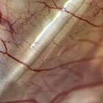 L’occhio è l’unico punto del corpo umano in cui possiamo osservare direttamente il microcircolo, senza strumenti invasivi.