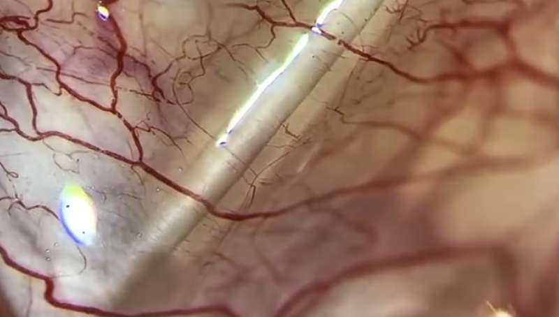 L’occhio è l’unico punto del corpo umano in cui possiamo osservare direttamente il microcircolo, senza strumenti invasivi.
