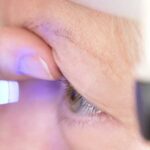 cura glaucoma con agopuntura, dr Marzio Vanzini