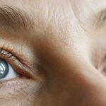 cura retinopatia diabetica- Metodo Boel e Laser Agopuntura. Dr M. Vanzini