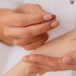 fotobiomudulazione agopuntura, rendere visibile gli effetti dell'agopuntura
