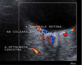ecodoppler prima dell'agopuntura