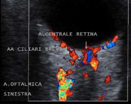 ecodoppler dopo l'agopuntura