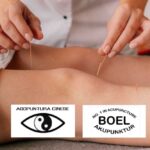 Cosa distingue l’Agopuntura Tradizionale Cinese dal Metodo Boel? agopuntura cinese e metodo Boel differenze